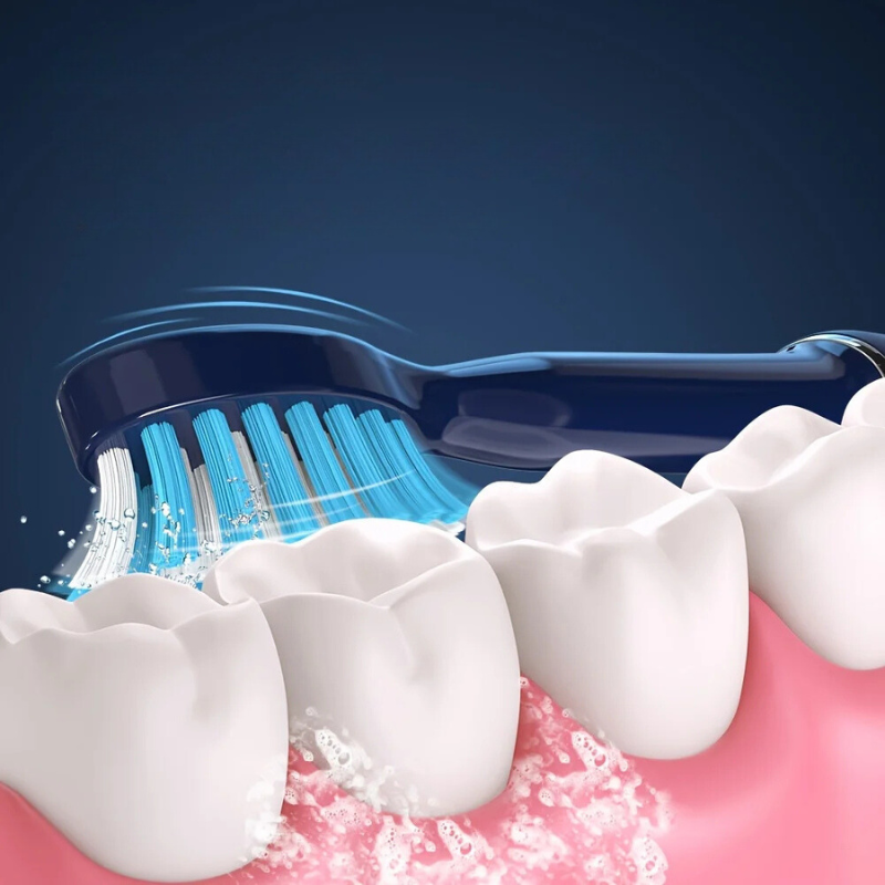 PlaqueAway Sonic Toothbrush with Comfort Control